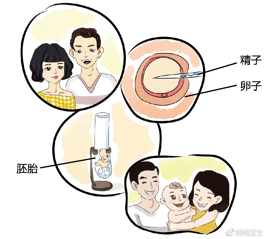 剖腹产读法