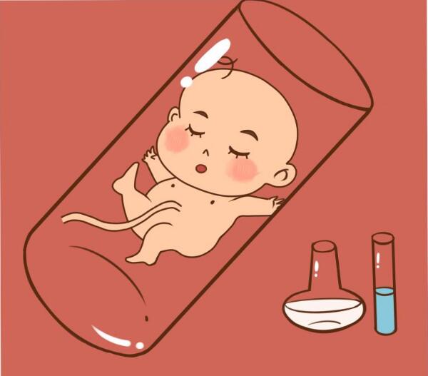 剖腹产