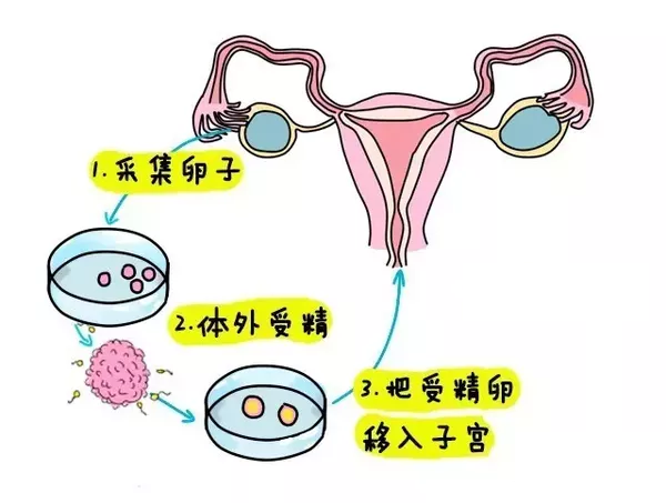 剖腹产二胎