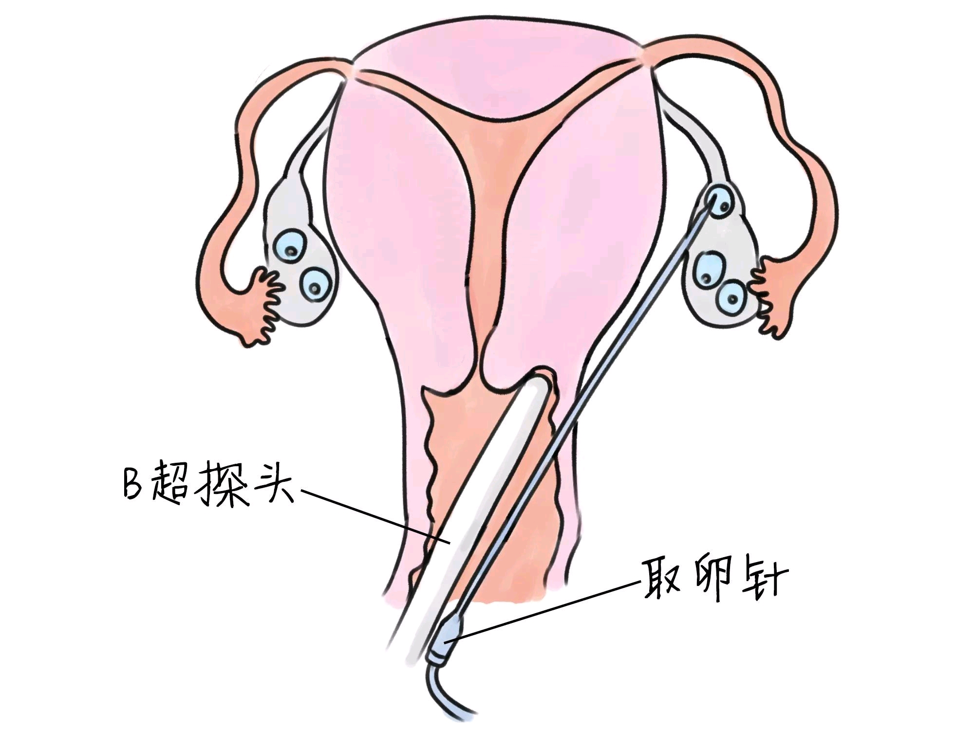 预产期