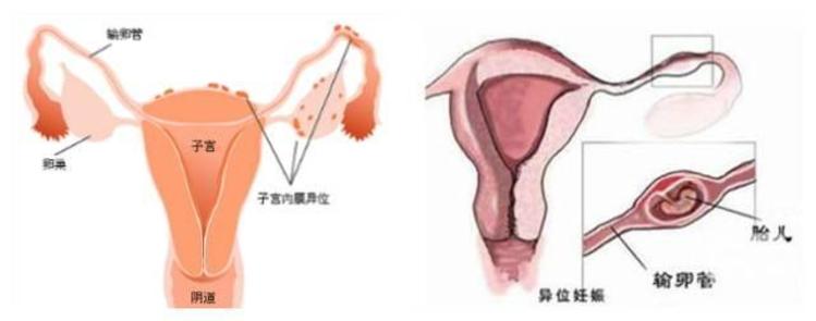 十个月宝宝