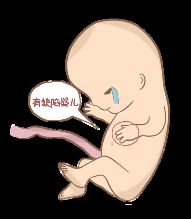 便秘
