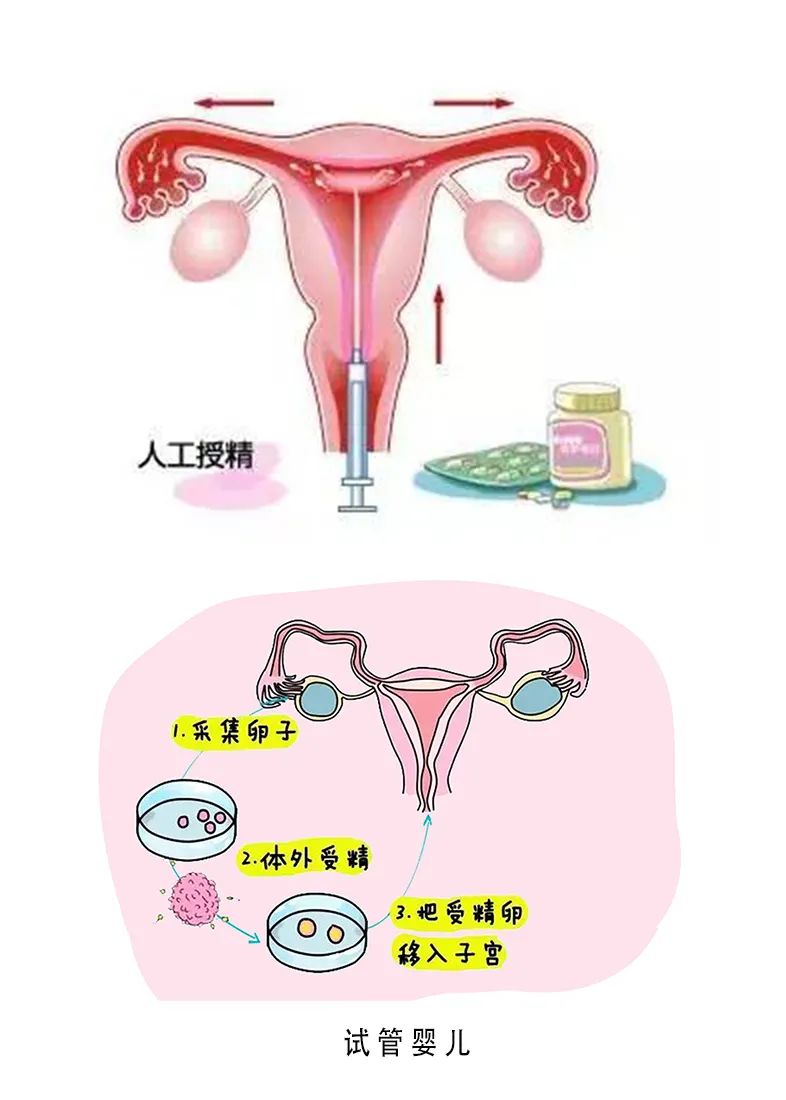 南宁试管婴儿