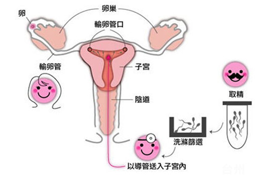 妊娠纹