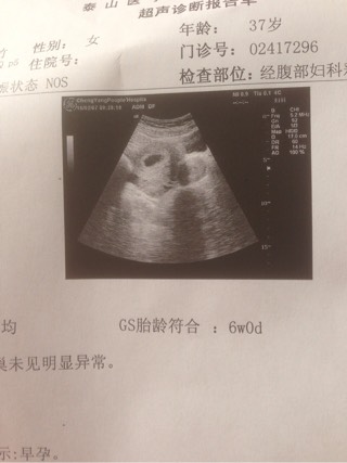妊娠纹