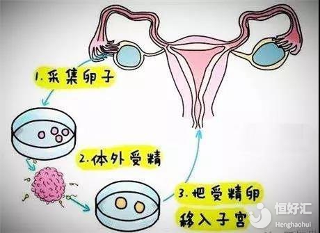 十六岁怀孕