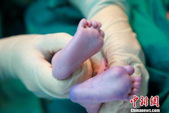 珠海试管婴儿价格