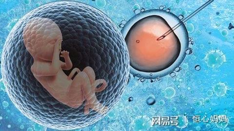珠海试管婴儿