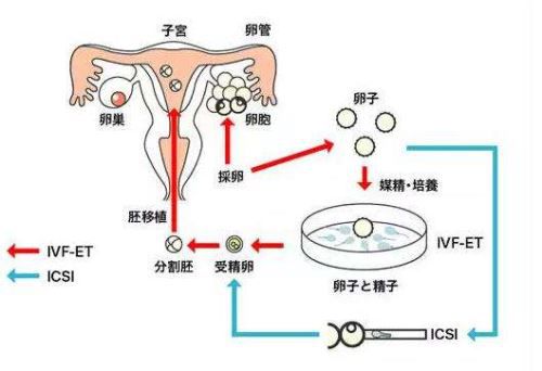 声乐学习